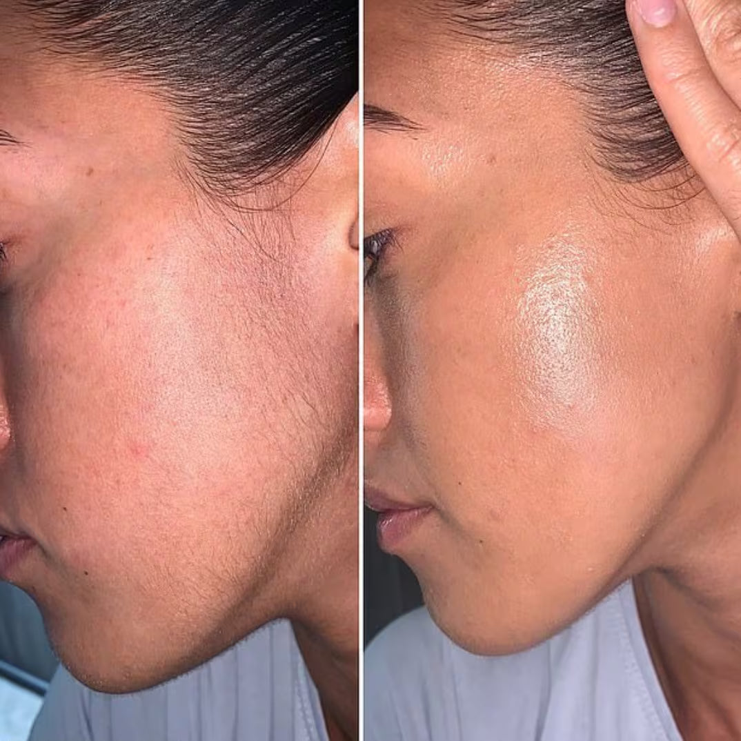 Epil Pro 3.0 - Épilateur visage