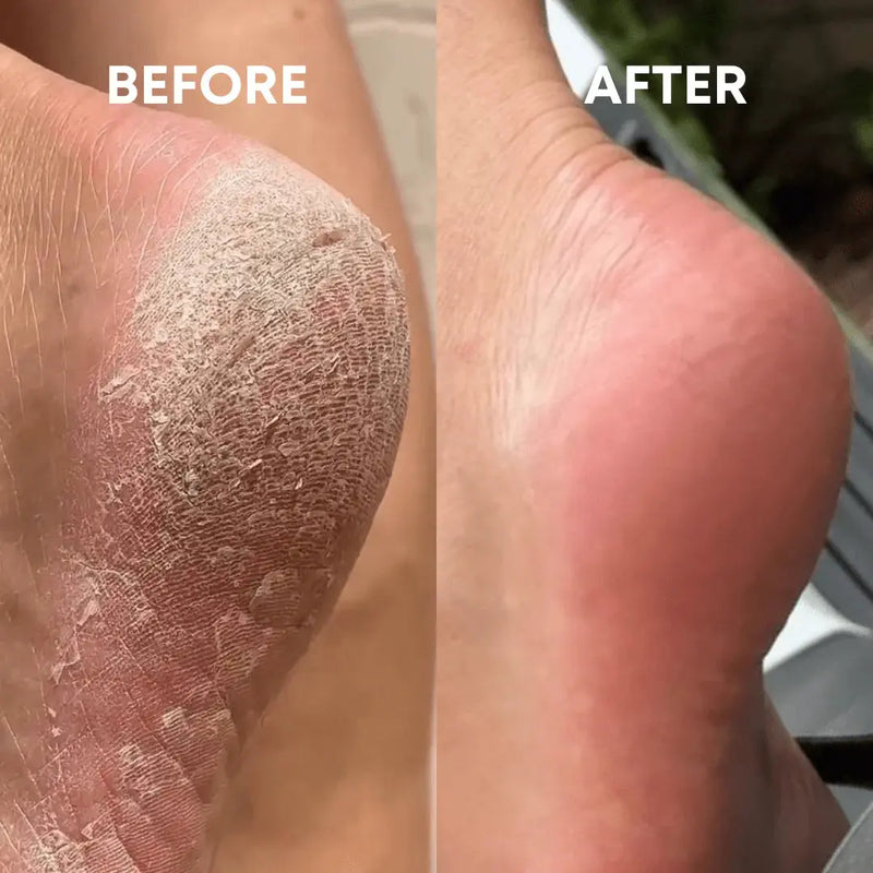 LunaLime - Lime à Pieds en Nano Verre épiluna
