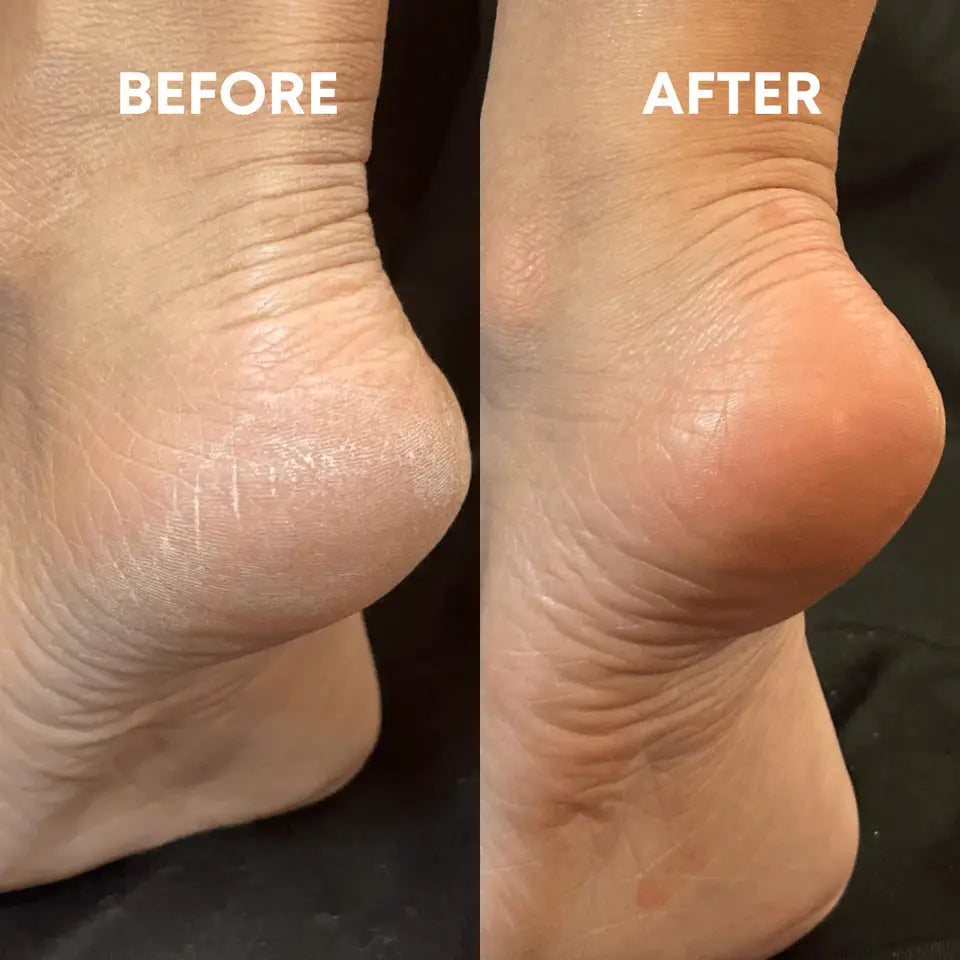 LunaLime - Lime à Pieds en Nano Verre épiluna