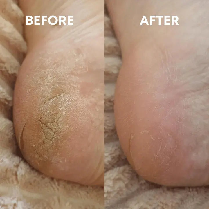 LunaLime - Lime à Pieds en Nano Verre épiluna
