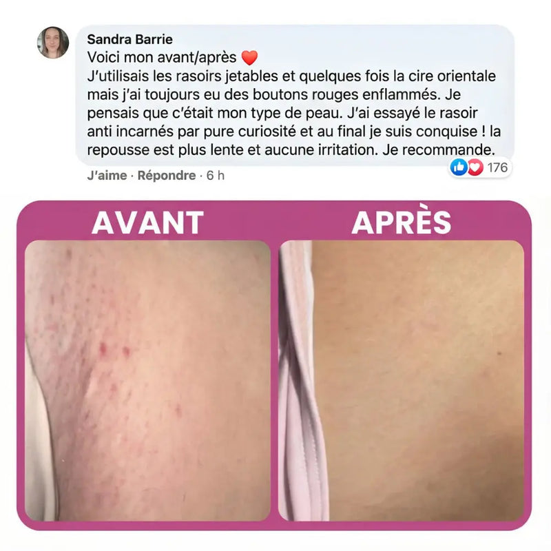 Rasoir ELIOS™ 5-en-1 épiluna
