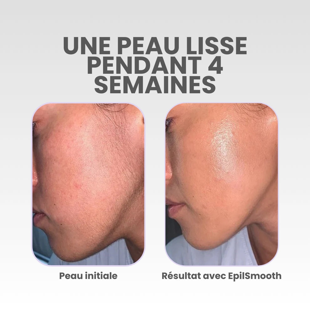 EpilSmooth - Épilateur visage