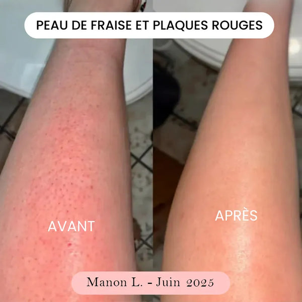 Manon L.