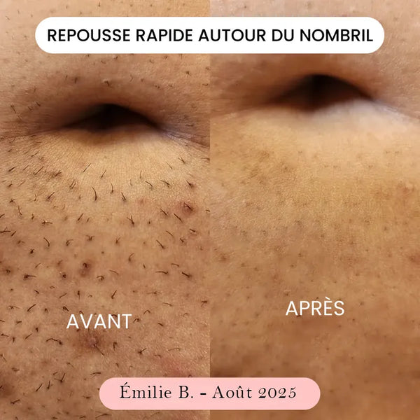 Emilie B.