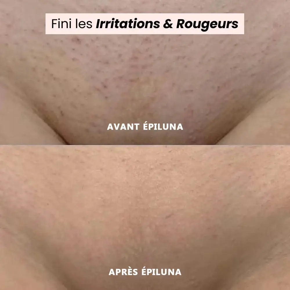 Rasoir 2en1 LunaShave épiluna